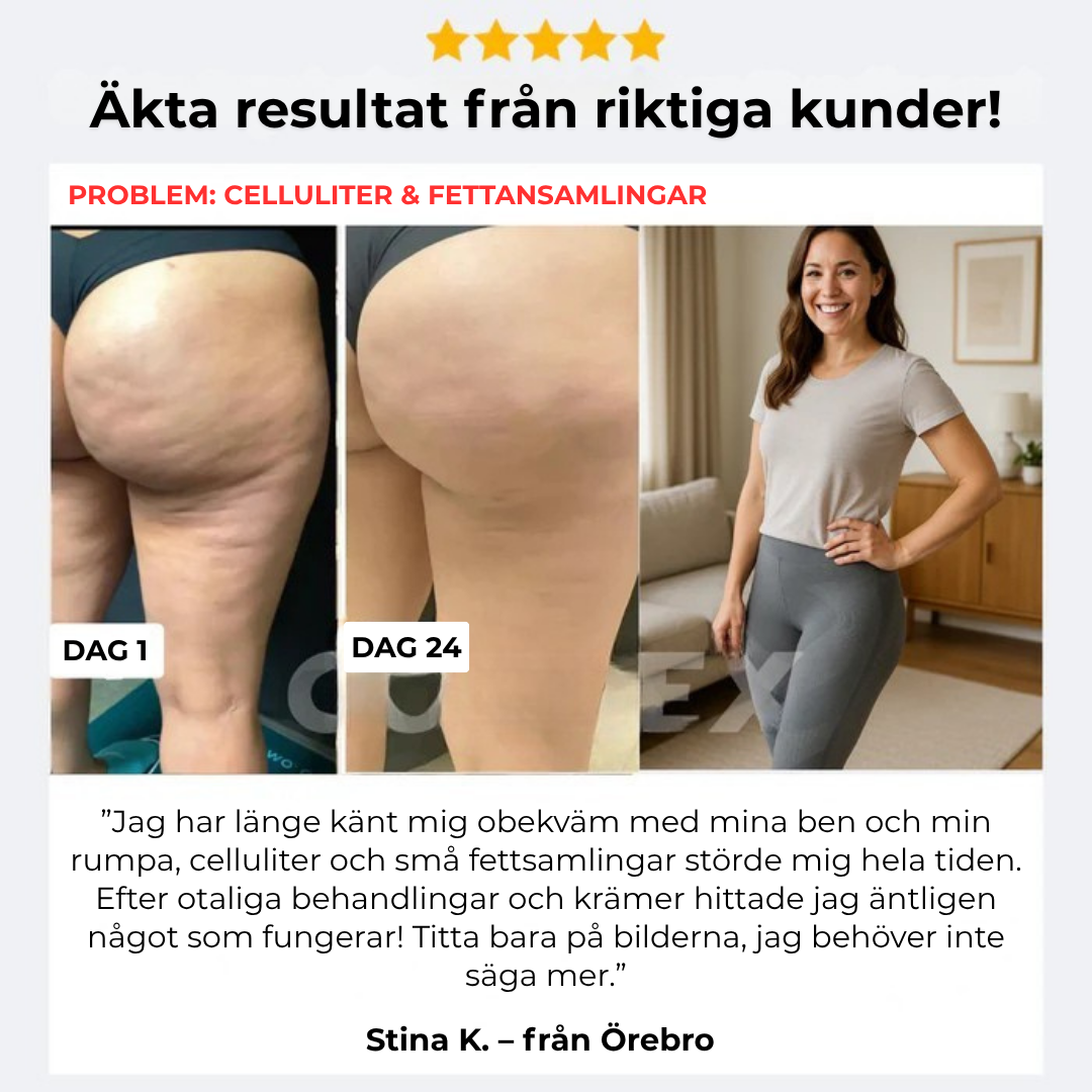 Velior FlexForm™ – 3D-Kompressionsleggings